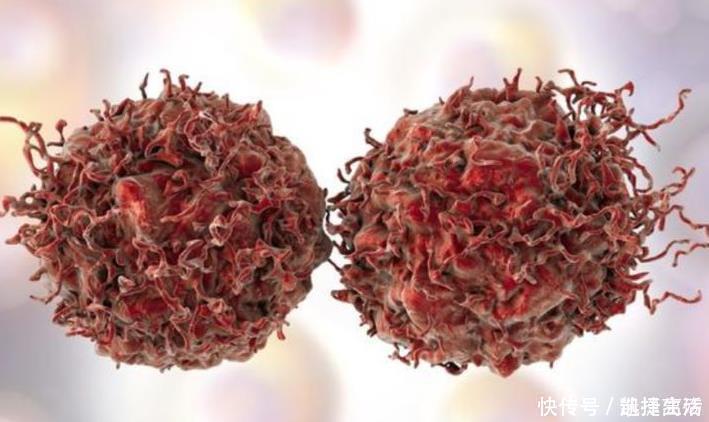 癌细胞|为什么癌症早期都不痛不痒、毫无症状看完受益终身
