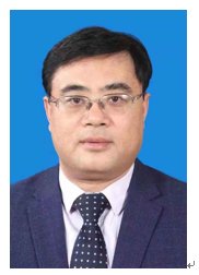 刘学键|山东省立三院两腺与血管瘤科刘学键团队：大医精诚，只为重燃患者生活热情