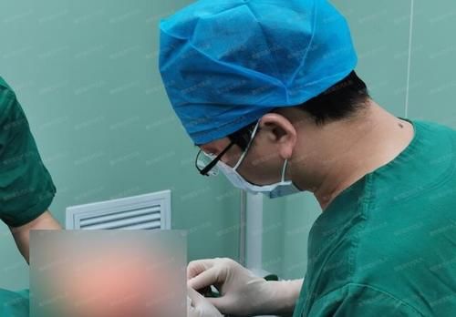 提眉手术给眼周带来多大变化，50岁姐姐来说说自己的“心路历程”