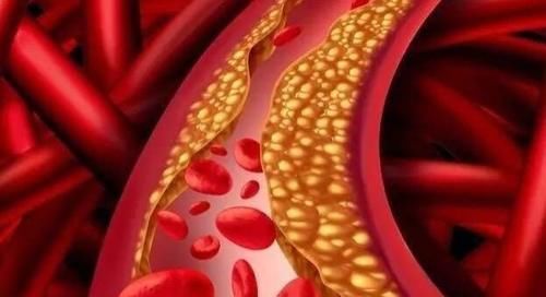 血脂|血脂偏高的朋友请注意:日常中4种食物或是降血脂小能手