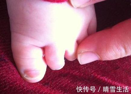 鞋子|5岁孩子双脚变形,只因长时间穿这种鞋子,父母要注意