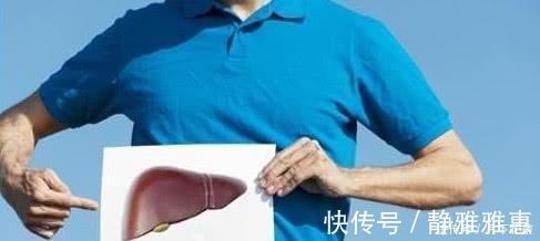 黑蒜|不起眼的几种食物, 是肝脏的“解毒王”每天吃一点, 排毒又养肝