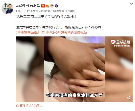 5月女婴使用抑菌霜后变大头娃娃？ 官方回应：涉事企业已暂停生产，责令召回下架涉事产品