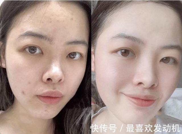 黑头|最近一款“变态洁面皂”火了,比洗面奶好用,用后黑头痘痘消失了!