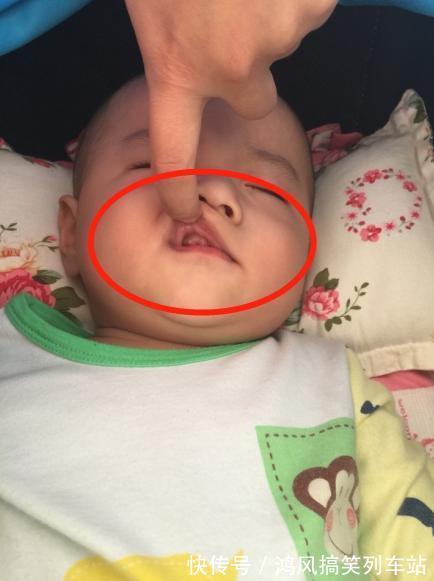小高|2岁儿子总喜欢“嘟嘴”,外婆看到后立马送去医院,医生:来晚了