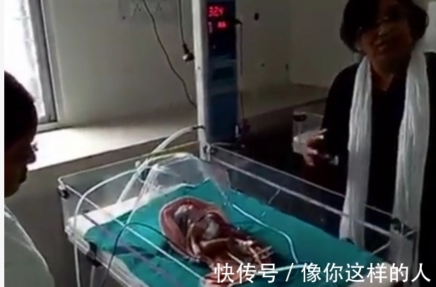 婴儿|女子怀孕10月,生下4手4脚异形婴儿,医生却这样解释!