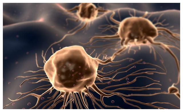 五姐妹|一家五姐妹全部得癌症,还是晚期,医生惋惜有些钱不能省