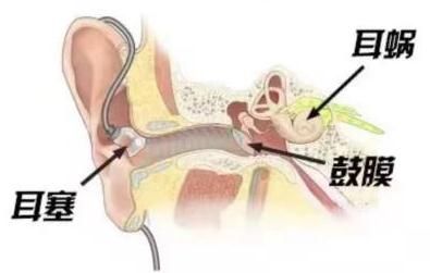 听力|哪些不良习惯会引起耳病？听力损伤如何预防？一起来看→