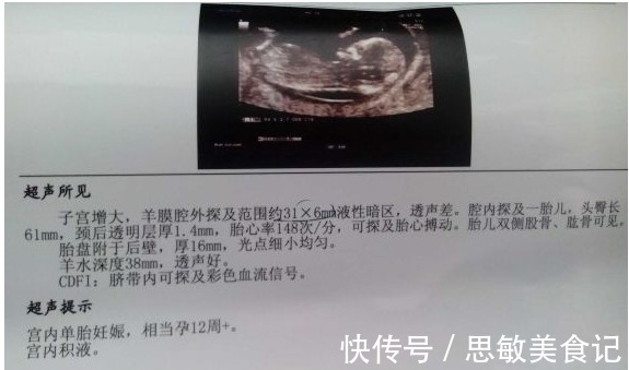 早孕检查|怀孕期间,这5项检查能安全通过,说明宝宝健康聪明,准妈可放心