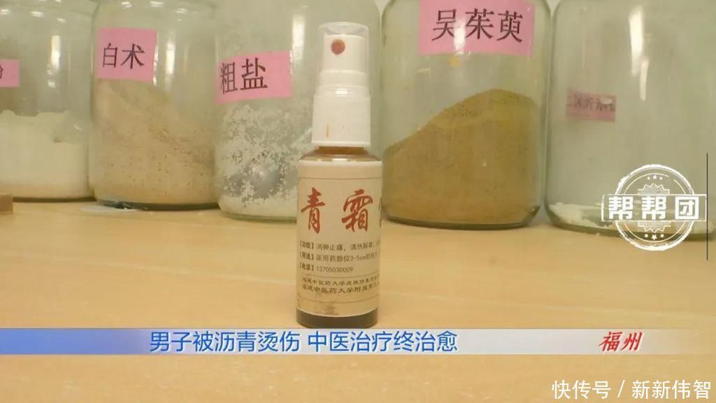 惊心!滚烫的沥青从头浇下,男子全身多处遭遇严重烧烫伤