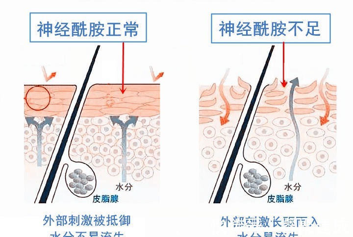 受损|为什么我天天敷面膜天天补水，反而皮肤越来越不好了呢？