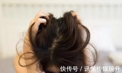 李女士|河北一女子用“硫磺皂”洗头,三个月后,头发有什么变化?