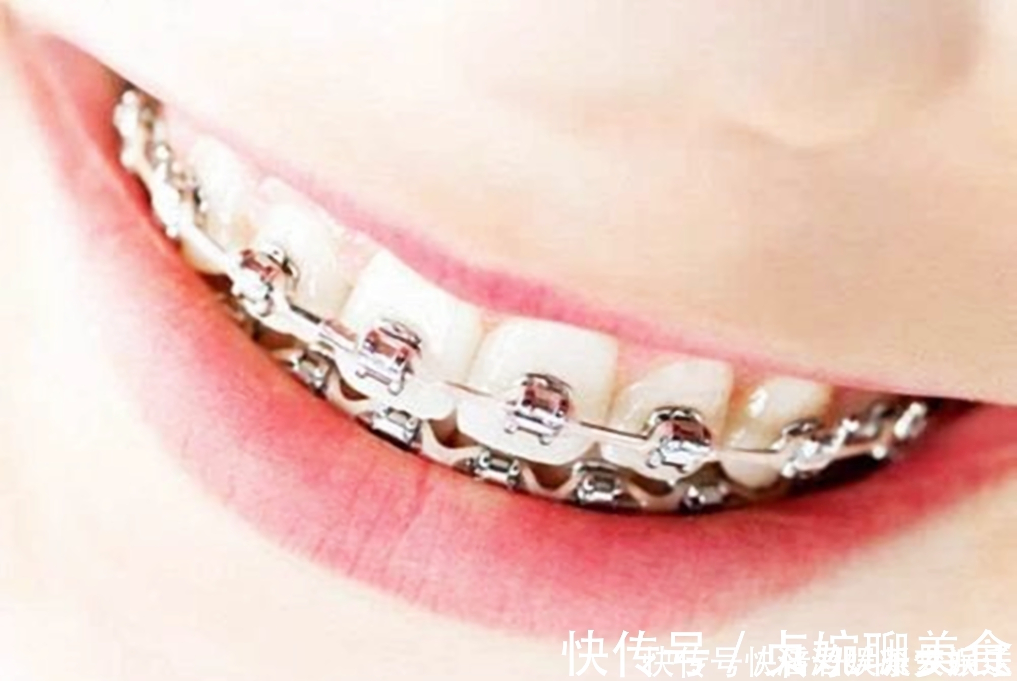 父母|好不容易等到宝宝换牙期,新牙却长歪了医生家长无知惹得锅