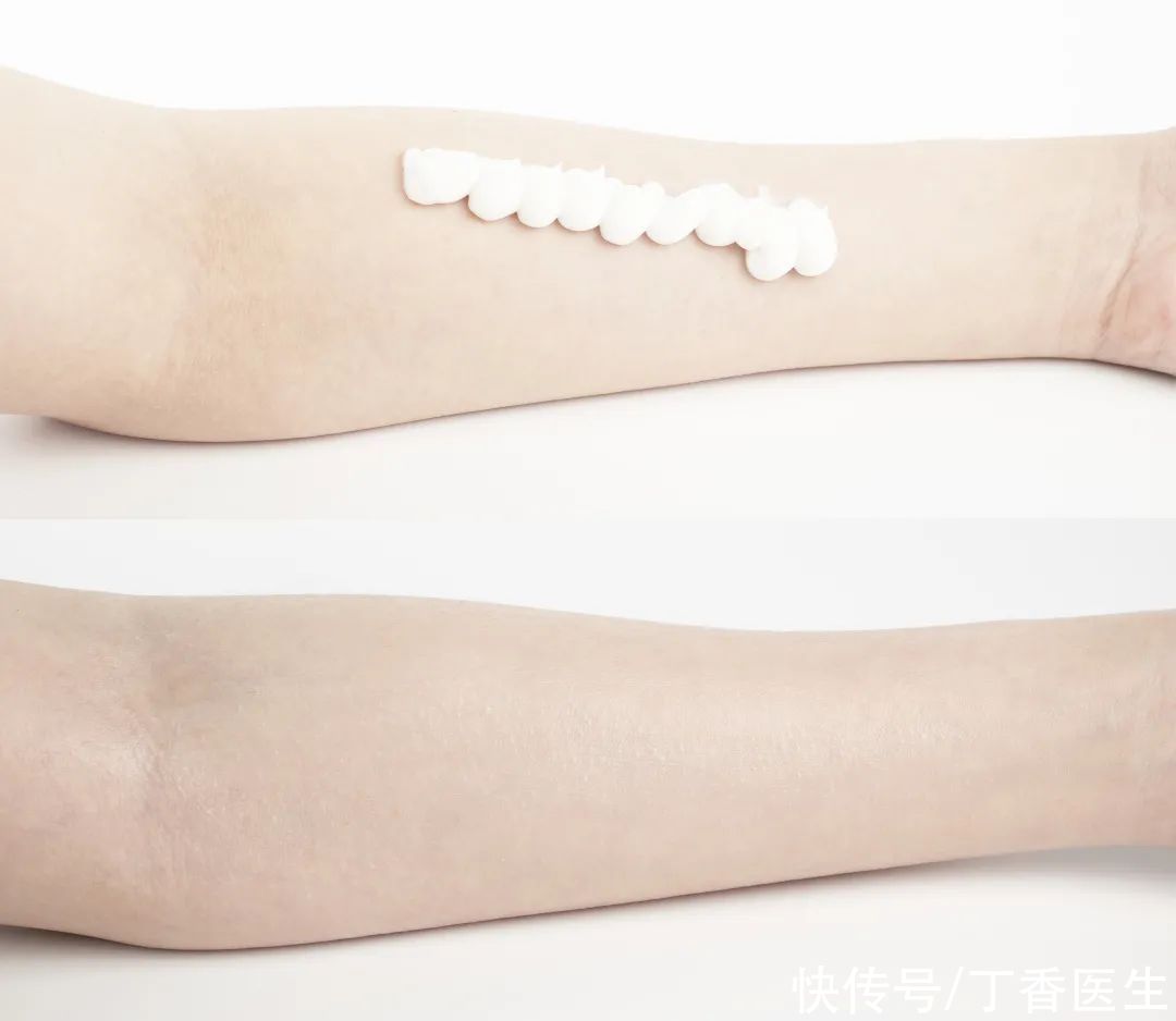 吊带|吊带印、短袖印太尴尬？两招让皮肤亮回来！