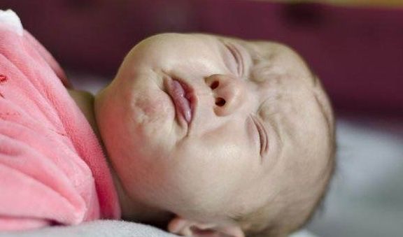 过敏|如果宝宝喝奶粉后有这3个表现，宝妈要给宝宝换奶粉了，别大意！