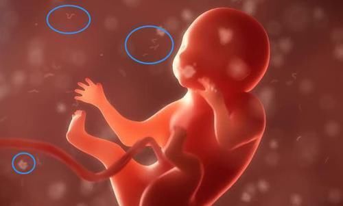 危险|33岁产妇分娩时突然咳嗽,5分钟后永远闭上了眼,这事孕妈别大意