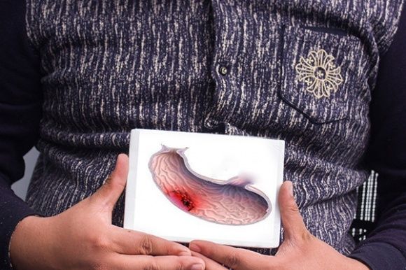 防治|癌转移的患者家属依然不放弃！胃癌该如何防治？