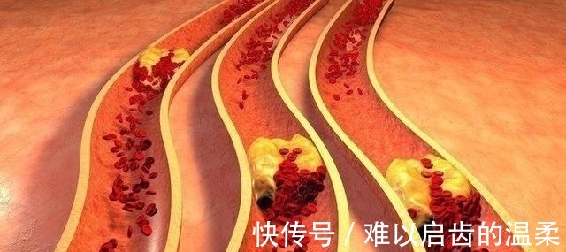 医生|切除胆囊,对身体有什么影响吗医生终于讲出大实话