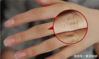 日本变态手霜,效果堪比“换皮”轻轻一抹,双手一夜重回婴儿肌