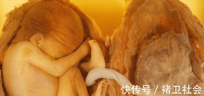 孕妈|孕妇怀孕3个月,肚子大到行动不便,孕检后一家人很纠结