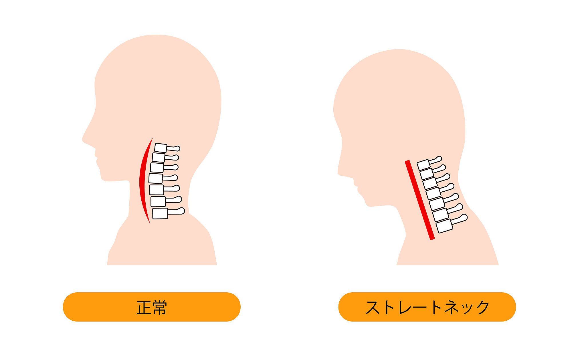 健康|颈椎不适真不能随便“按”! 五招预防颈椎病、三个动作自测肩颈健康