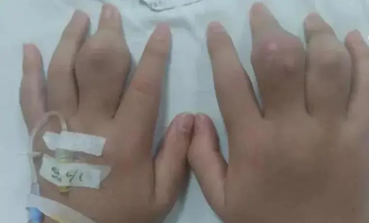 小强|30岁小伙突然抽搐、昏迷不醒!只因狂喝这个年轻人爱的