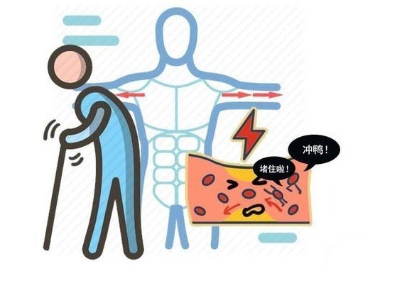 头晕|脑供血不足头晕，应如何护理？不妨多吃5种食物，有助血管健康