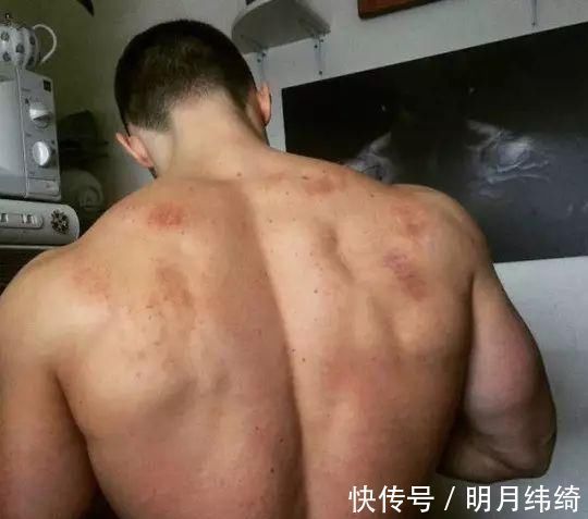 膝盖|5个血淋淋的案例告诉你，错误的健身动作会造成多大的伤害