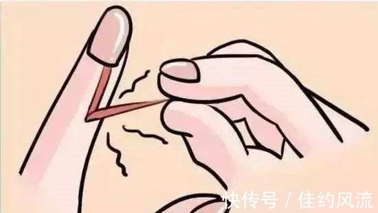 指甲|没有妇科问题的女性,手部通常会有以下3种特征显现