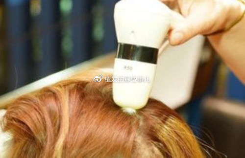 植发原理？带你揭秘植发手术完整流程|植发科普| qt:ghost