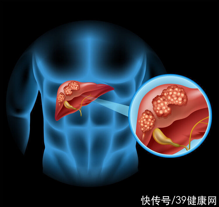 小姗|家中9人患上同一种癌！提醒：得了这3种癌症，可能“传”给下一代