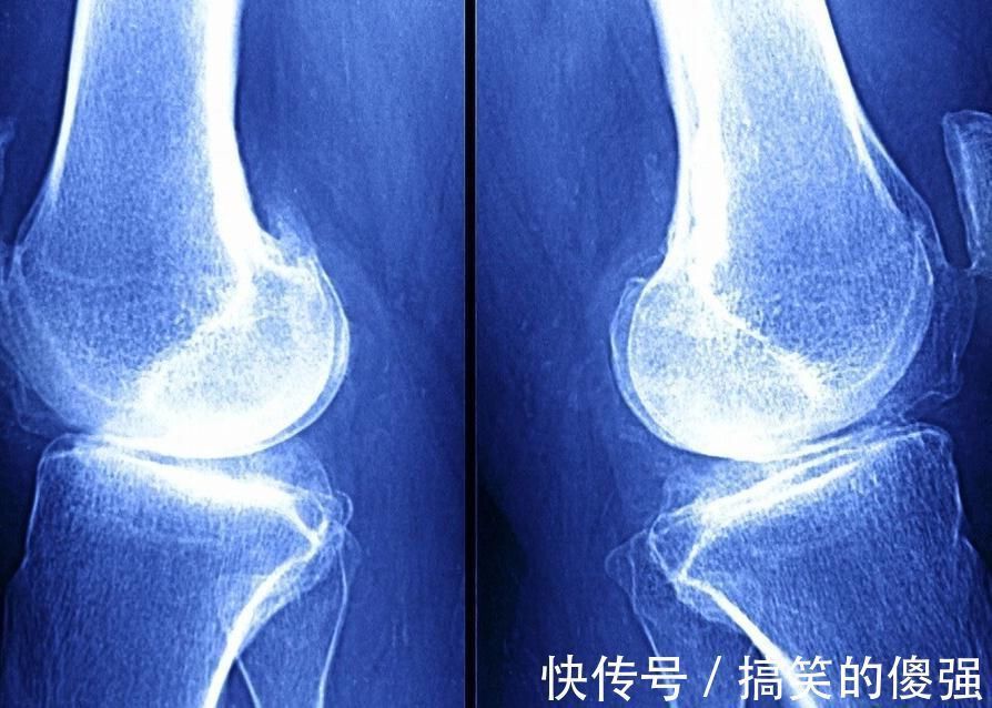 身高|孩子迟迟不长个并非“天生矮”，抓住3个特征，两个月猛蹿10公分