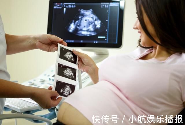 胎宝|头胎是来报恩的?建议“保头胎”不是迷信,产科医生说出原因