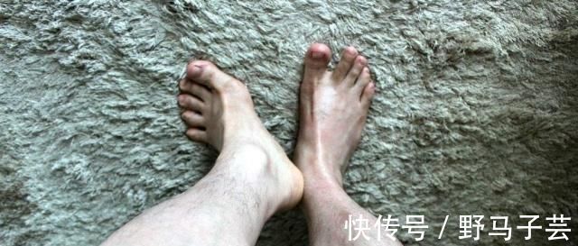 男人味|雄性激素过旺的男人，可能有两个特征，你若能占1个，恭喜了