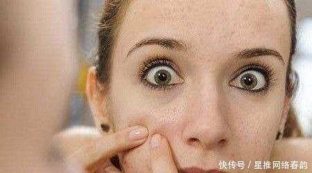 炎症|应该先去以前的旧痘印,还是先去新长出来的痘痘?