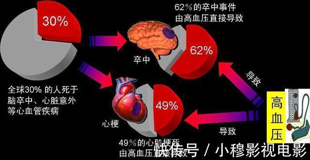 动脉硬化|2022“新血压标准”已公布,不再是120/80mmHg,高血压患者应了解