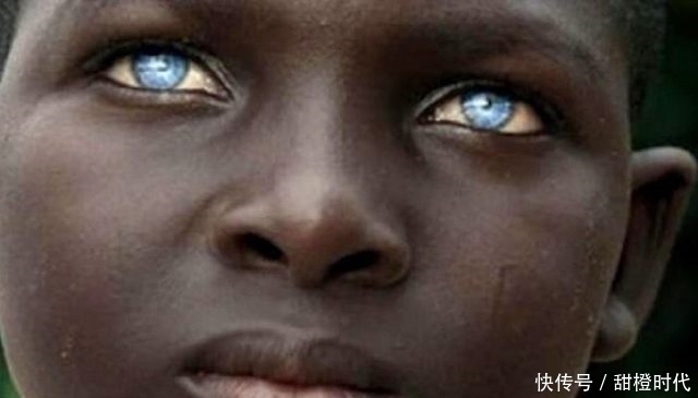 黄一蓝|世界上“最美”的9双眼睛,胜过一切美瞳,最后一个宛如天使!
