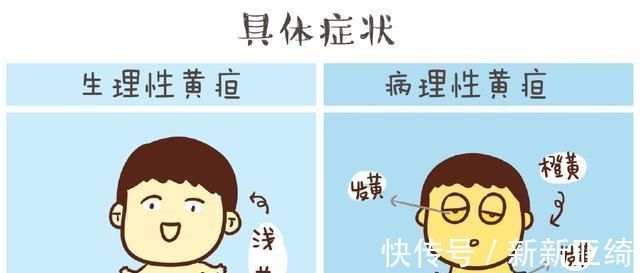 准妈妈|宝宝黄疸严重,只因准妈妈在孕期做了这3件事儿,现在改还不晚