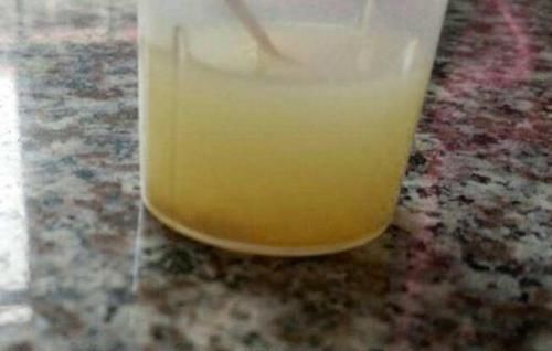 家庭盆栽花草，怕黄叶烂根就喂点药，这些越过期效果越好