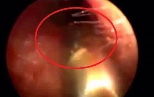 床头|男孩半夜“耳朵疼”,宝妈拿灯一照慌忙送医,这些东西别放床头了