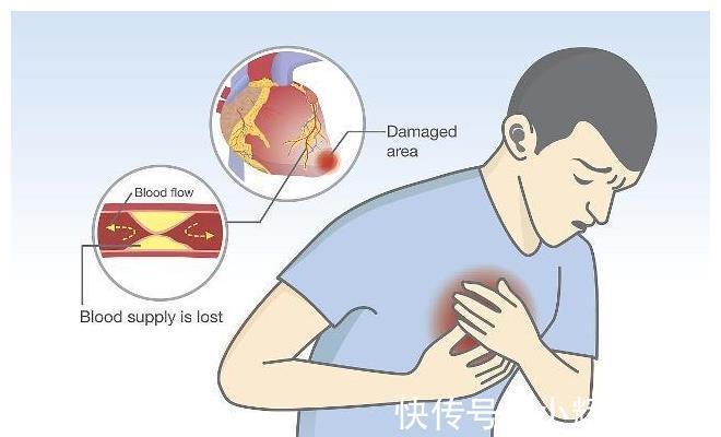 甲状腺|甲状腺结节能自愈吗?如果能少碰这些食物,结节可能会悄悄散去