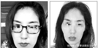 号称能瘦脸的徒手整骨是不是忽悠!