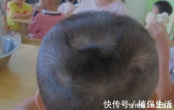 父母|为什么有的孩子头上有“2个旋”?代表啥意思,父母都应知道下