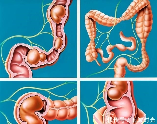 肠胃病|夏季吃生姜的9大好处,难怪每天要吃点姜