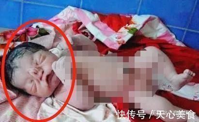 畸形儿|高龄产妇生下野猪娃,丈夫被吓得后退,医生的话挽救整个家庭