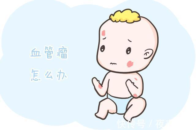 硬化剂|宝宝有血管瘤怎么办?不要慌,看这篇就明白了