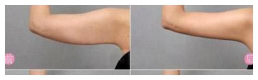 张科峰|“高端玩家”女海王翻车,但富二代仍然不愿退婚,只因身材太完美