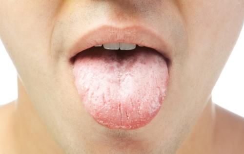 瘀斑|从舌望心，你的心有没有问题，看舌就知道了