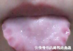 口干口苦|早晚吃一物,排出体内多年湿气,健康又漂亮,神奇!