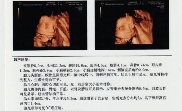 或许|孕期四维彩超,能看懂检查报告的这三点,胎儿或许就没有小秘密了